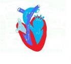 Coeur