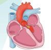 Coeur
