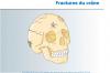 Fractures du cr ne