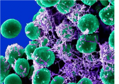 P inflam et infectieux s3 et 4 min