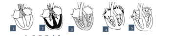 Schémas de la contraction cardiaque