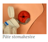 Stomie 11 min