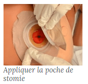 Stomie 15 min