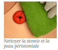 Stomie 5 min