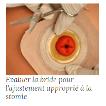 Stomie 9 min